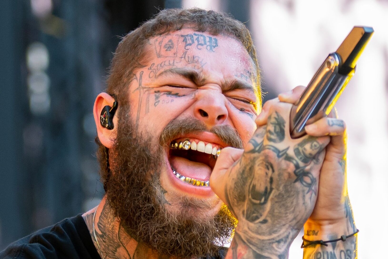 Post malone teeth a look at his amazing transformation