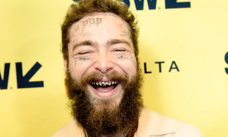 Post Malone Teeth